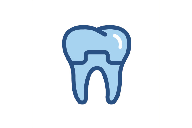 Dental Crowns in Martensville